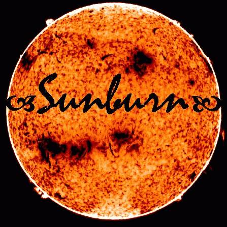 Sunburn